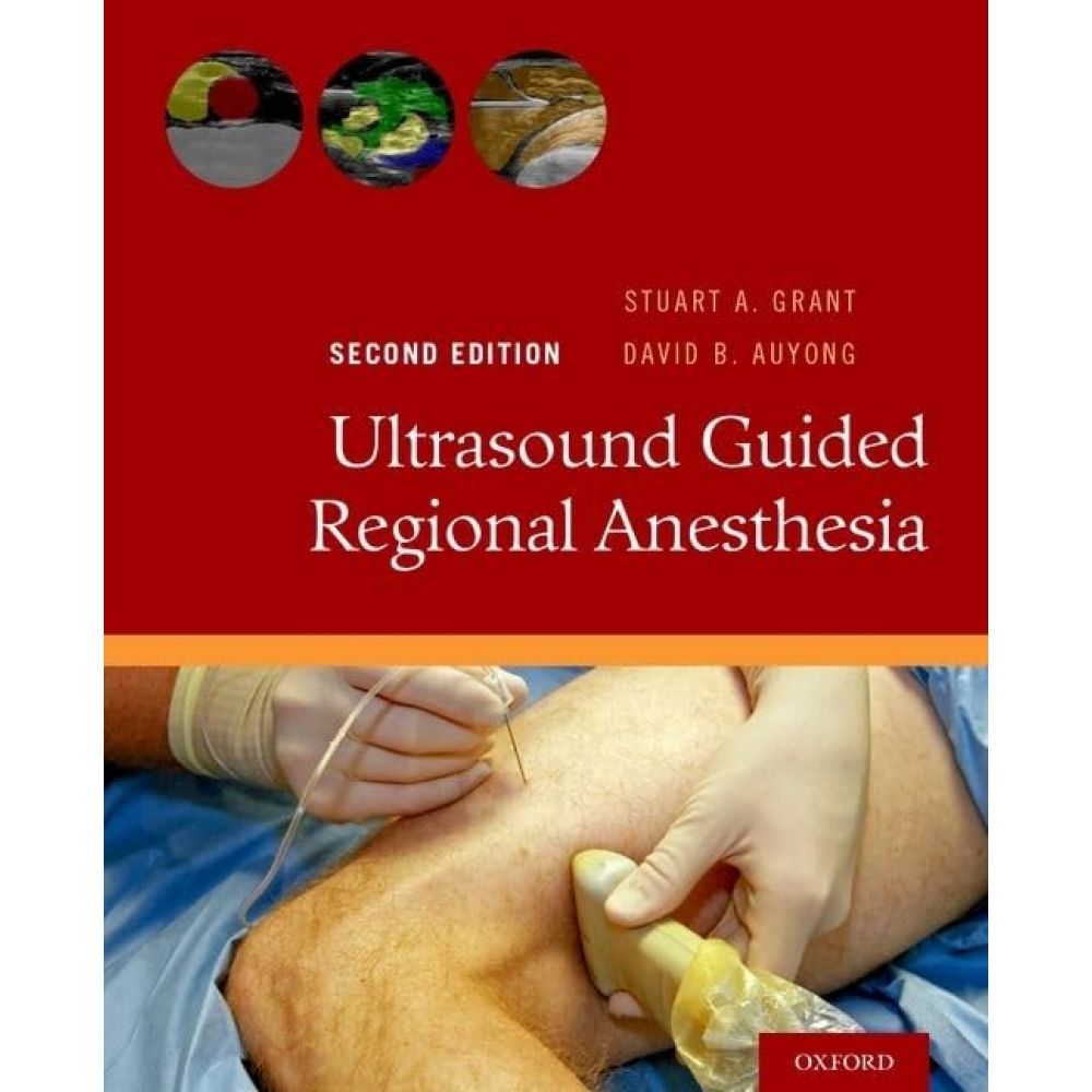 Ultrasound Guided Regional Anesthesia (2nd Edition)