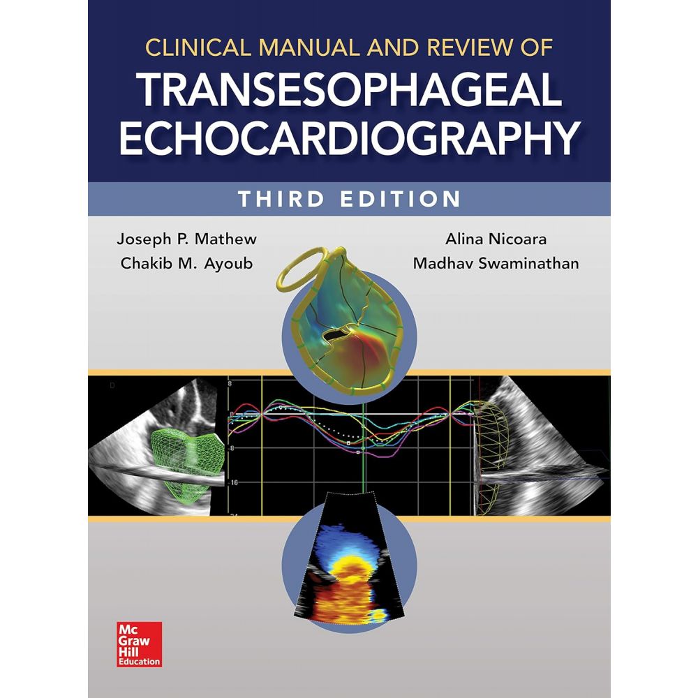 Clinical Manual and Review of Transesophageal Echocardiography 3rd Edition