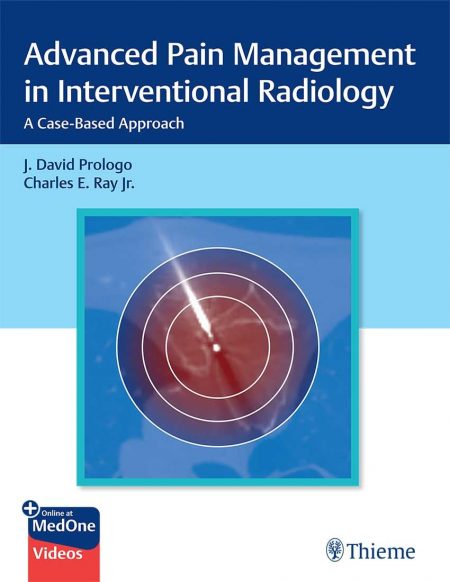 Advanced Pain Management in Interventional Radiology: A Case-Based Approach 1st Edition 2025