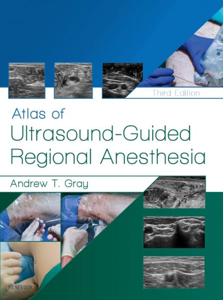Atlas of Ultrasound-Guided Regional Anesthesia 3rd Edition