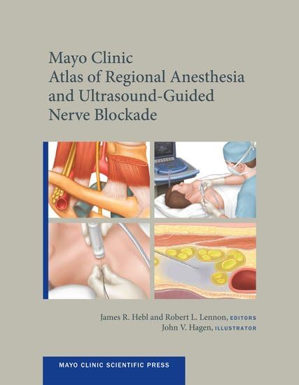 Mayo Clinic Atlas of Regional Anesthesia and Ultrasound-Guided Nerve Blockade 1st Edition