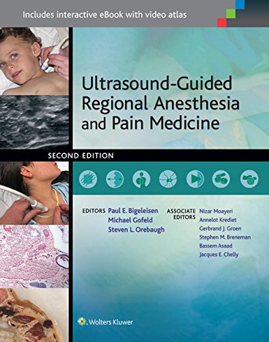 Ultrasound-Guided Regional Anesthesia and Pain Medicine 2nd Edition