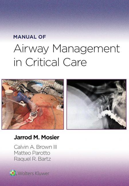 Manual of Airway Management in Critical Care: eBook without Multimedia