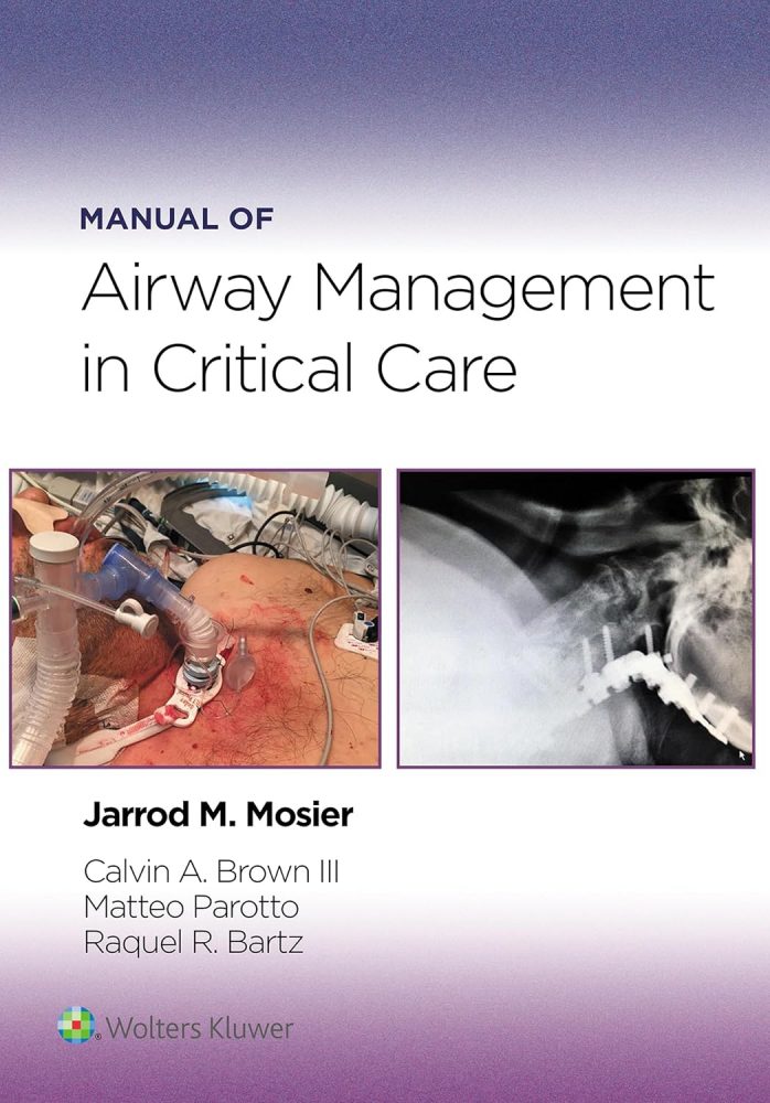Manual of Airway Management in Critical Care: eBook without Multimedia
