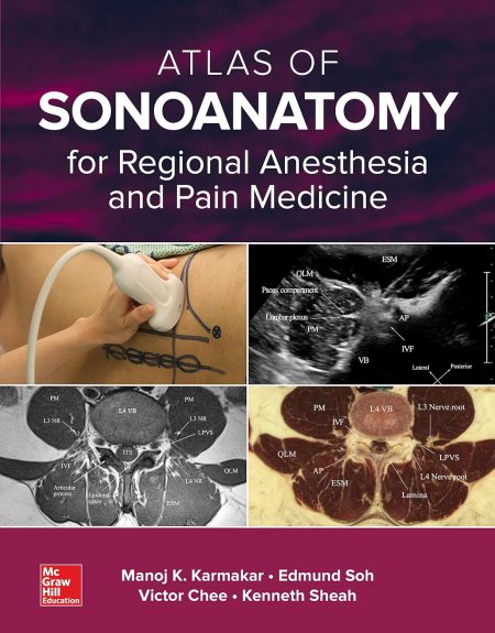 Atlas of Sonoanatomy for Regional Anesthesia and Pain Medicine  1st Edition