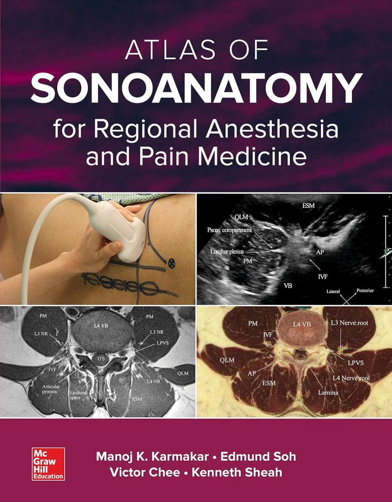 Atlas of Sonoanatomy for Regional Anesthesia and Pain Medicine  1st Edition