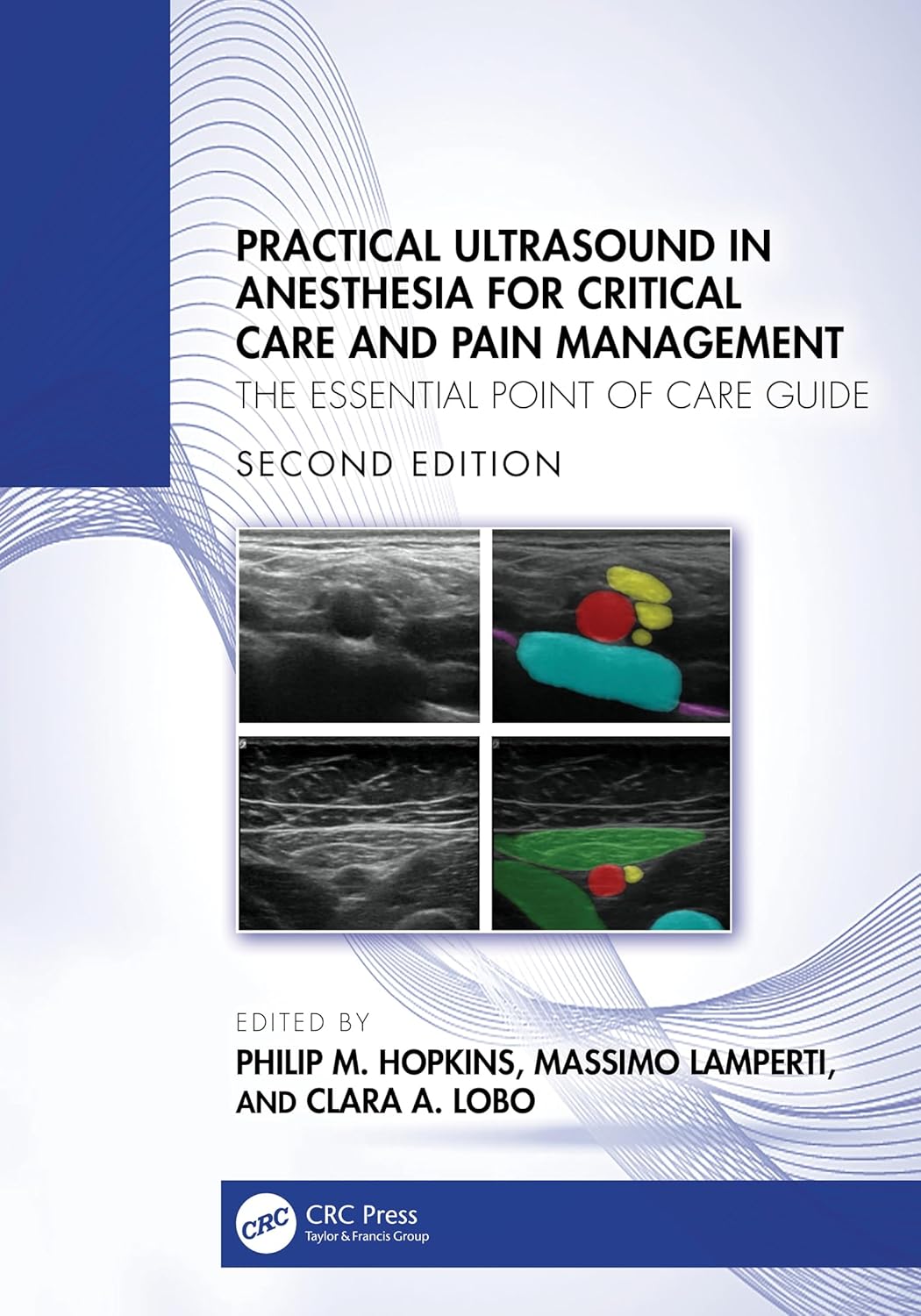 Practical Ultrasound in Anesthesia for Critical Care and Pain Management: The Essential Point of Care Guide  2nd Edition