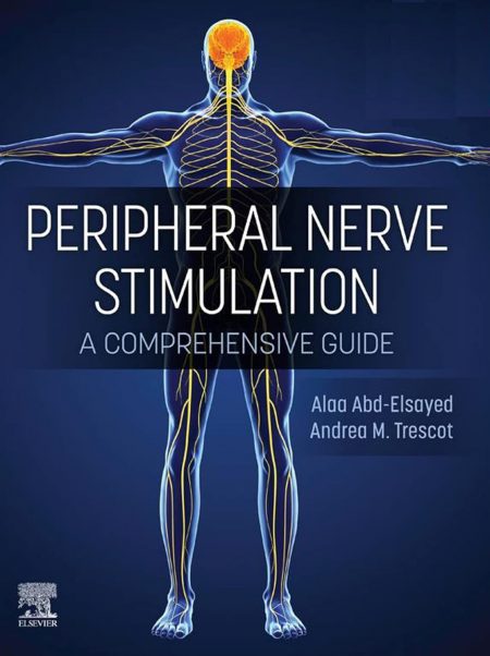 Peripheral Nerve Stimulation : A Comprehensive Guide