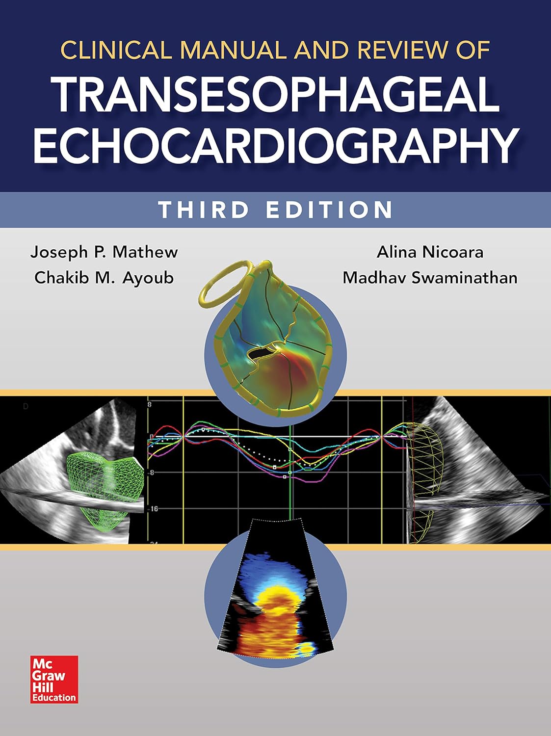 Clinical Manual and Review of Transesophageal Echocardiography, 3rd Edition
