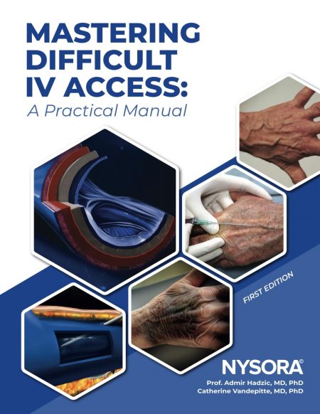 Mastering Difficult IV Access - a Practical Manual: First Edition