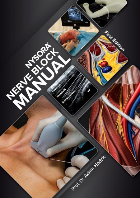 NYSORA Nerve Block Manual: First Edition