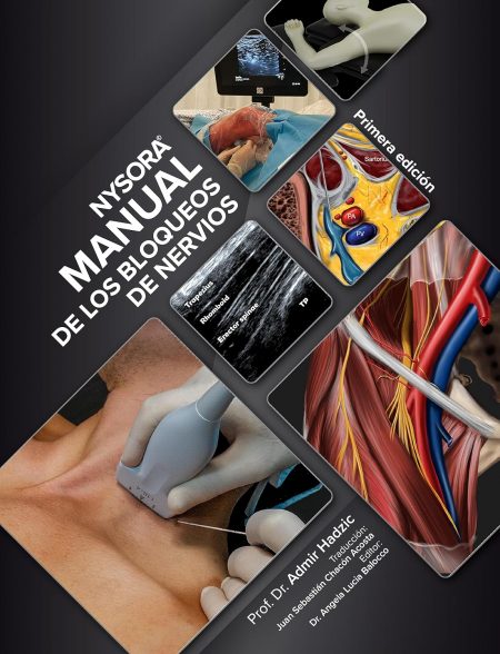 NYSORA Manual de los Bloqueos de Nervios: Primera Edición (Spanish Edition)